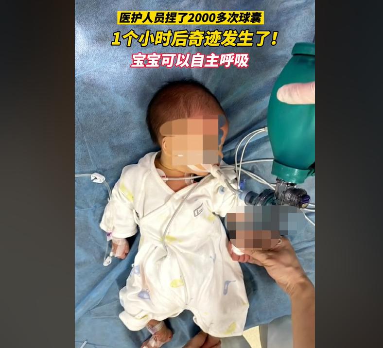 For 7 days, the baby choked with milk and lost his heartbeat to breathe