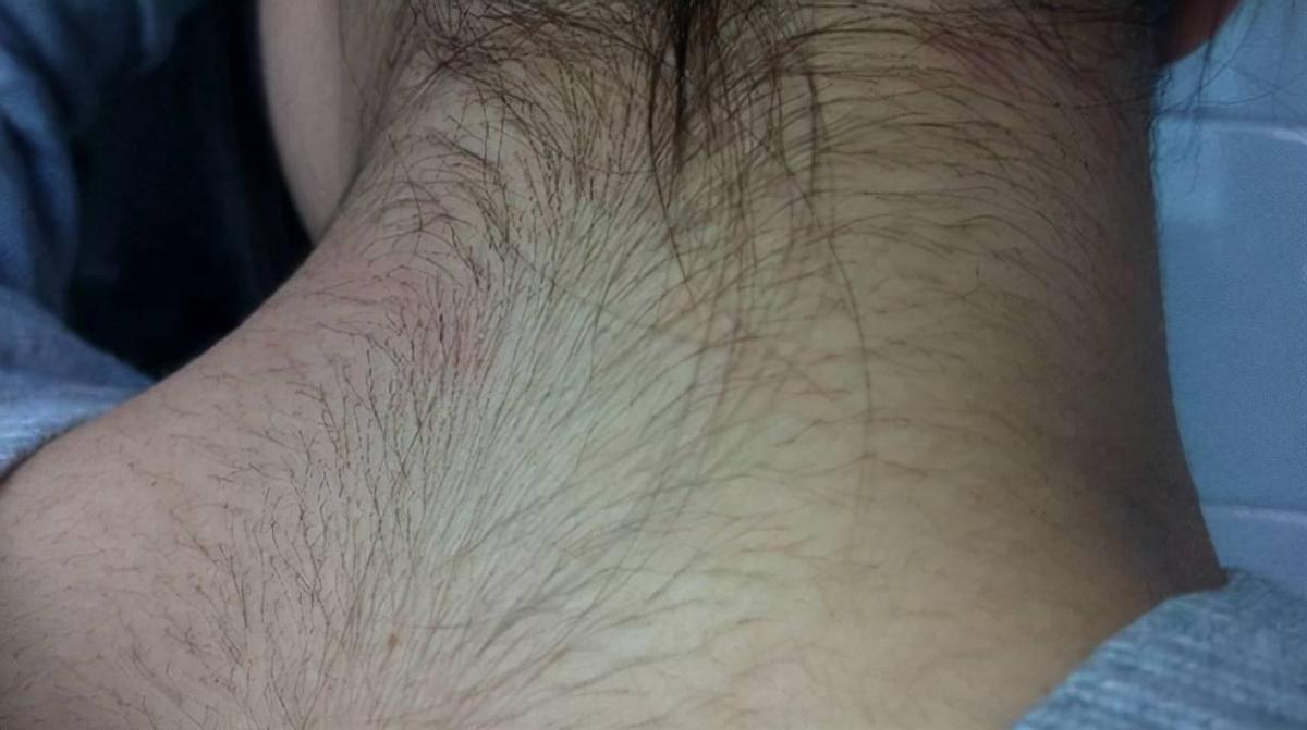 Why do some women have thick body hair, but some have very little body