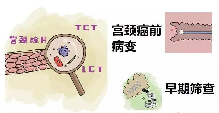 TCT、HPV報告單怎么看？一文教你讀懂宮頸癌篩查結(jié)果