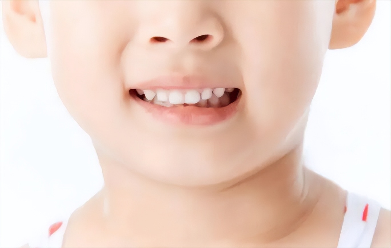 why-do-baby-teeth-grow-crooked-how-can-i-correct-my-child-s-crooked