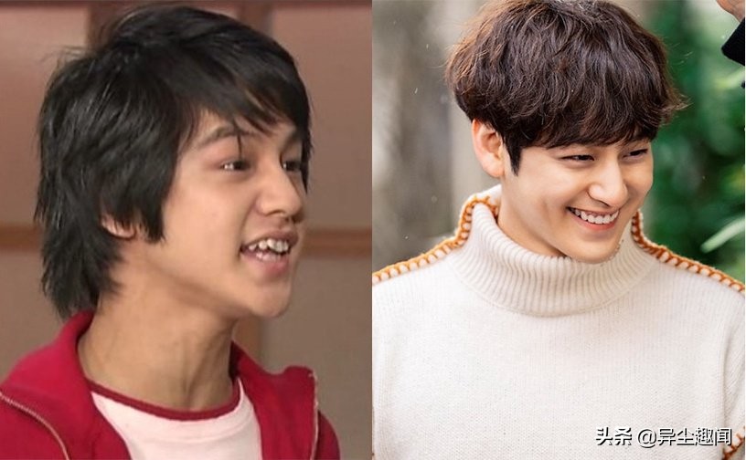 Korean Actor With Braces!Song Hye Kyo And Park Bo Young Also Have A History  Of Wearing Braces - Inews