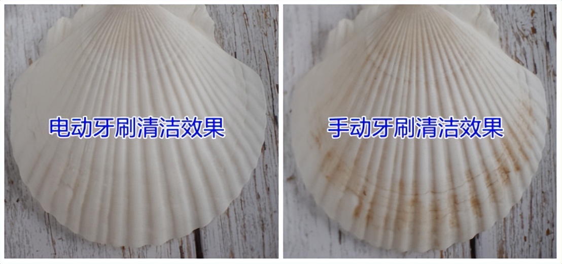 Can an electric toothbrush hurt your gums?Stomatologists reveal the hidden dangers of taboos iNEWS