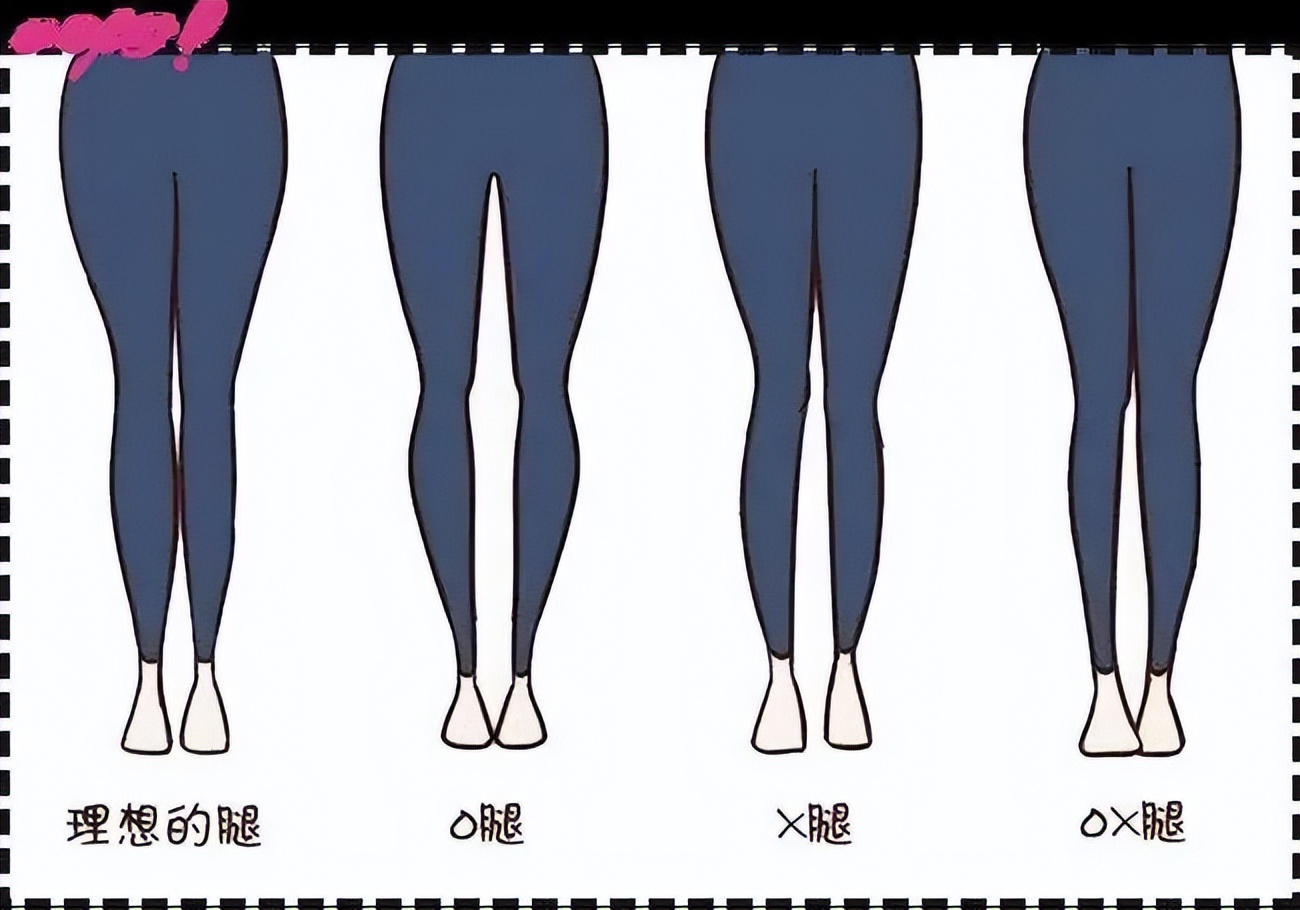 With ten years of life, look at the leg shape once iNEWS