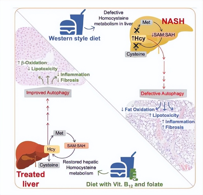 New study Vitamin B12 and folic acid may help treat advanced non