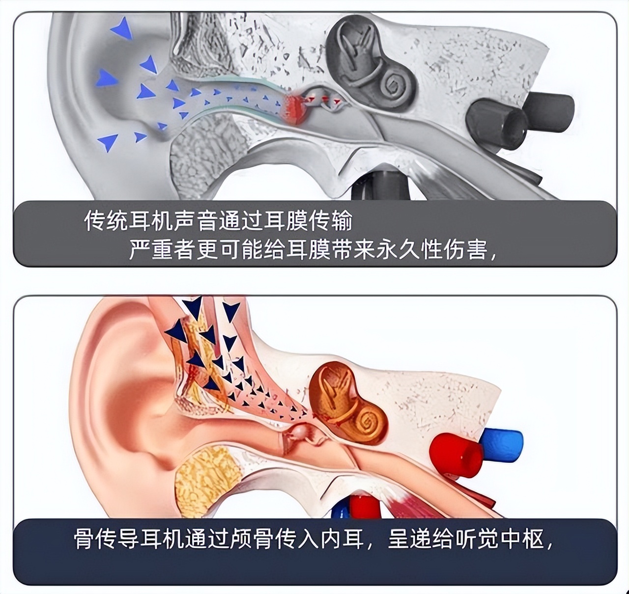 What is the effect of wearing headphones for a long time on the ears?Which earphones are the