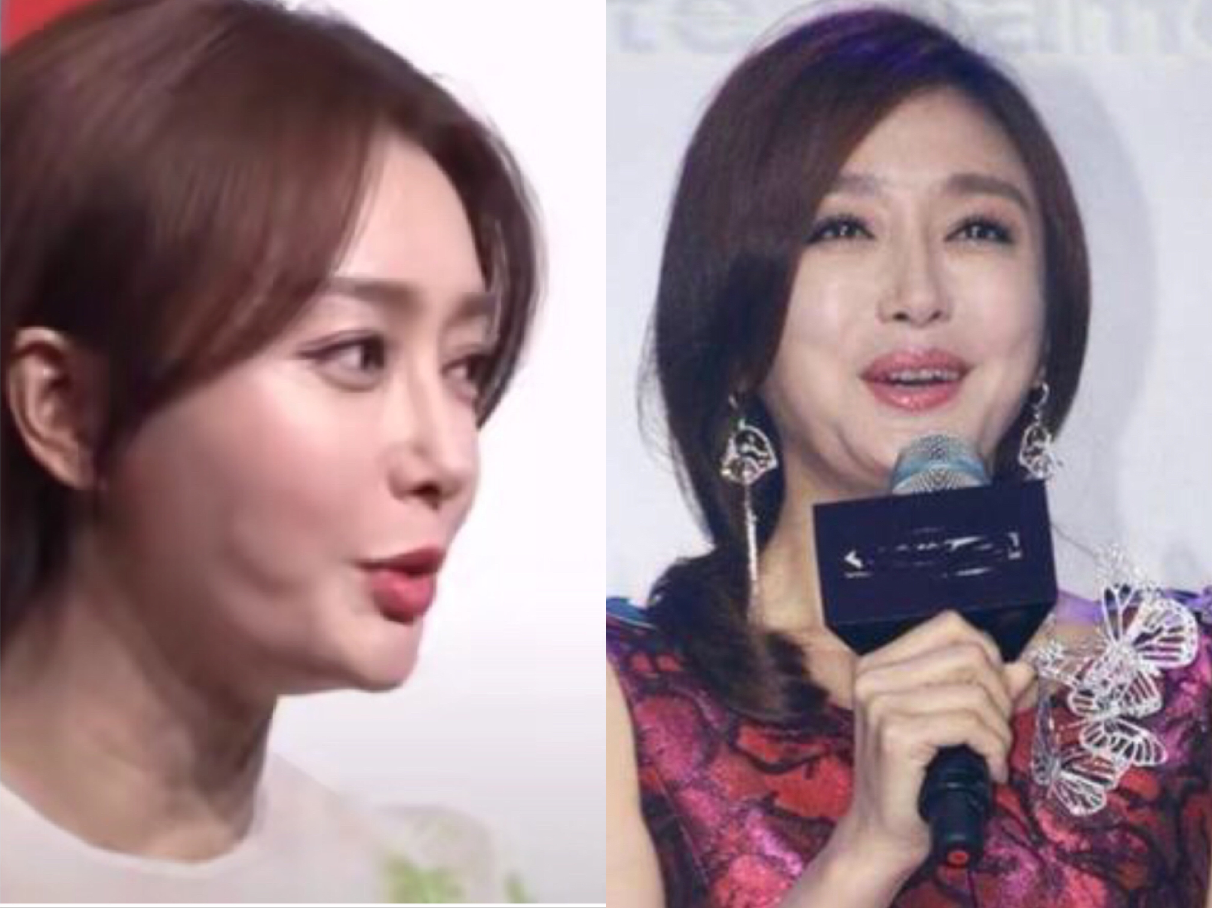 Double chins, sagging cheeks... the female star 