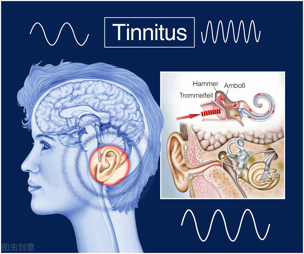 Ringing in the ears, what is the cause of tinnitus? iNEWS