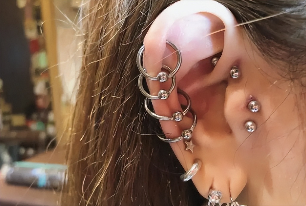 Do ear piercings cause keloids?Can ear piercing cause keloids? iNEWS