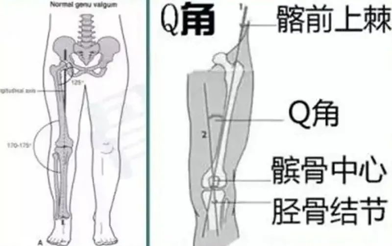 Q angle theory and its clinical significance iNEWS