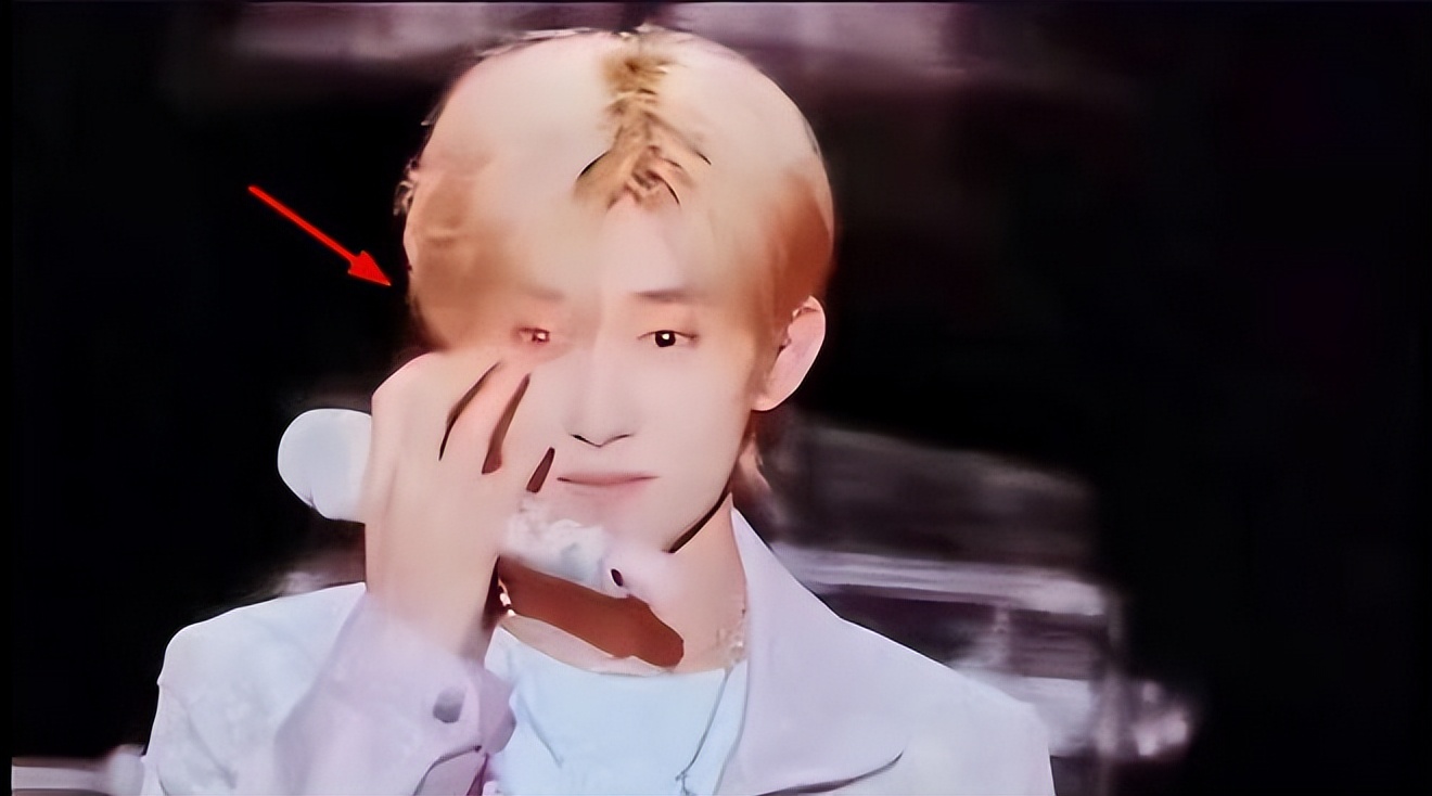 Three accidents at the concert Yi Yangqianxi was shot in the eye by a