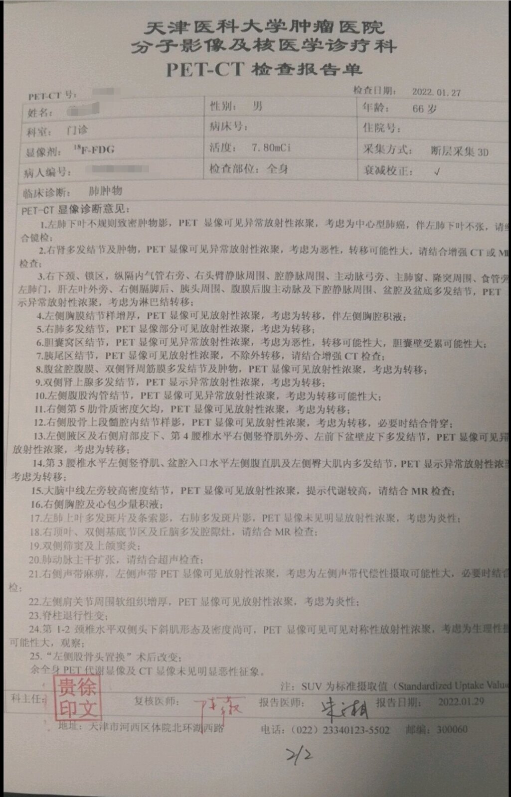 Dr Liu Yi Said That There Are Not Many Patients With Lung Cancer Three Three Three New Year S Eve Services And This Patient Has A Warning Significance Inews