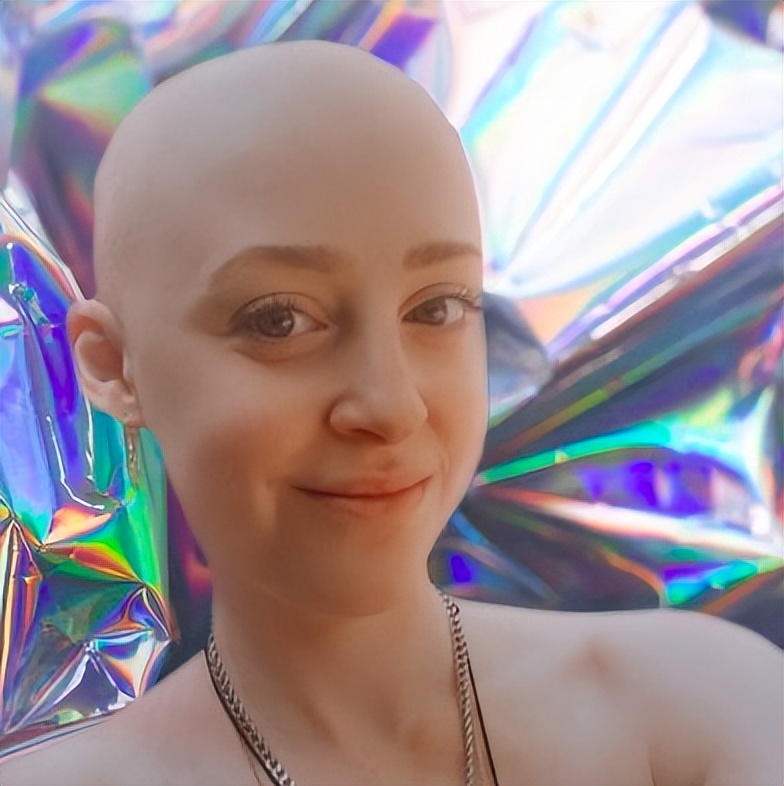 Only 28 years old! The post95 Canadian female star died, and this disease happened again! She