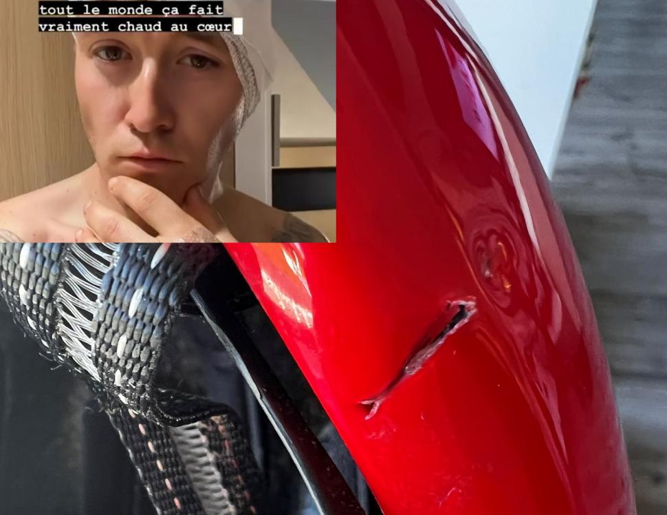 35 stitches of cyclists injured on disc brake road bikes, are disc