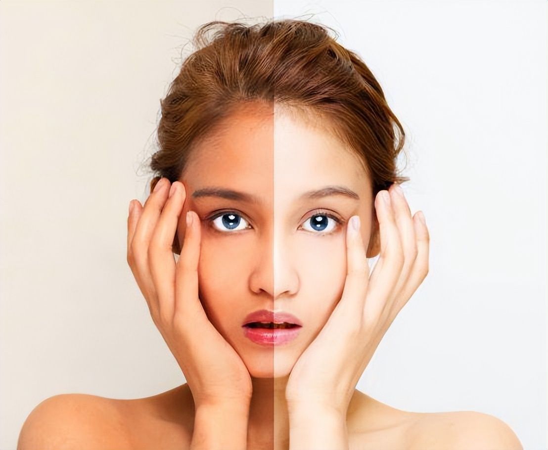 The complexion is dark and yellow, how can I change it?Teach you 3