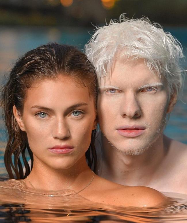 Georgia The Most Handsome Albino Singer Married A Young Model Gave Birth To A Beautiful Son 8079