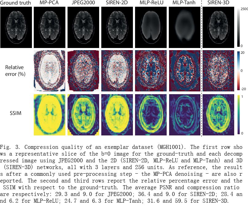 Lossy compression of multidimensional medical images using sinusoidal ...