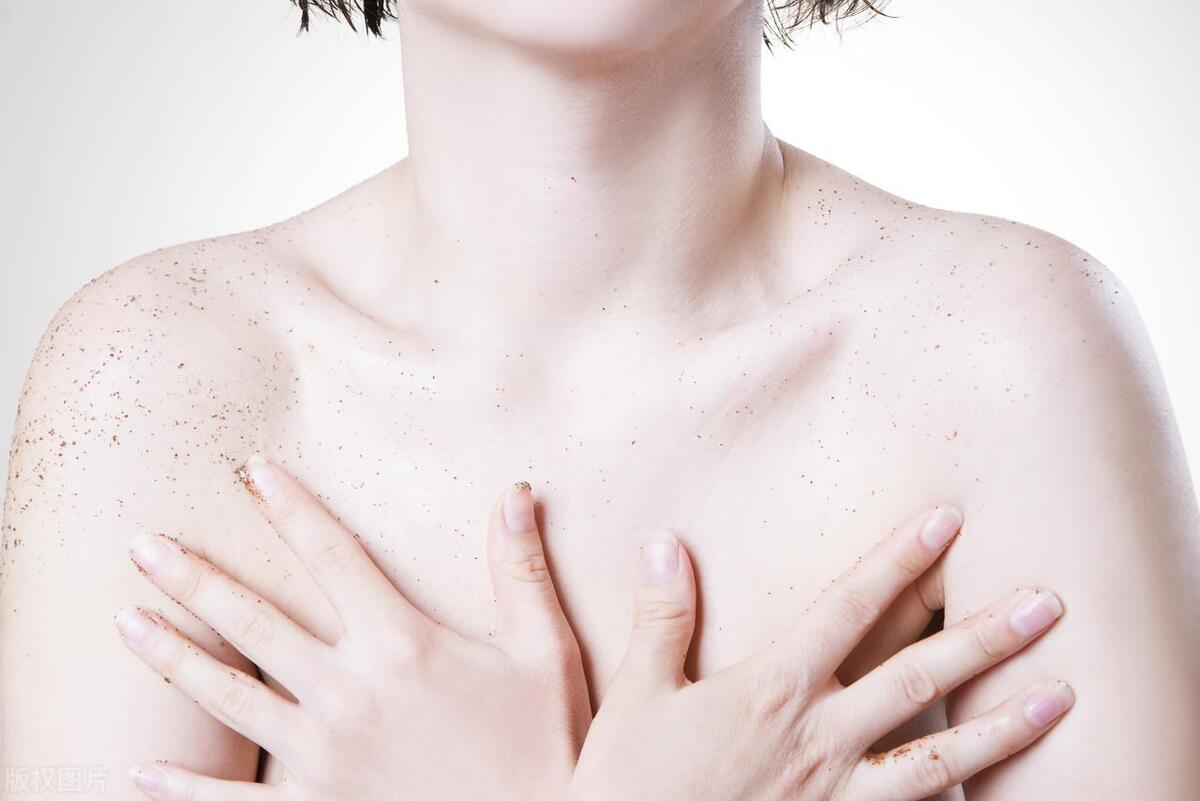 巨乳症 