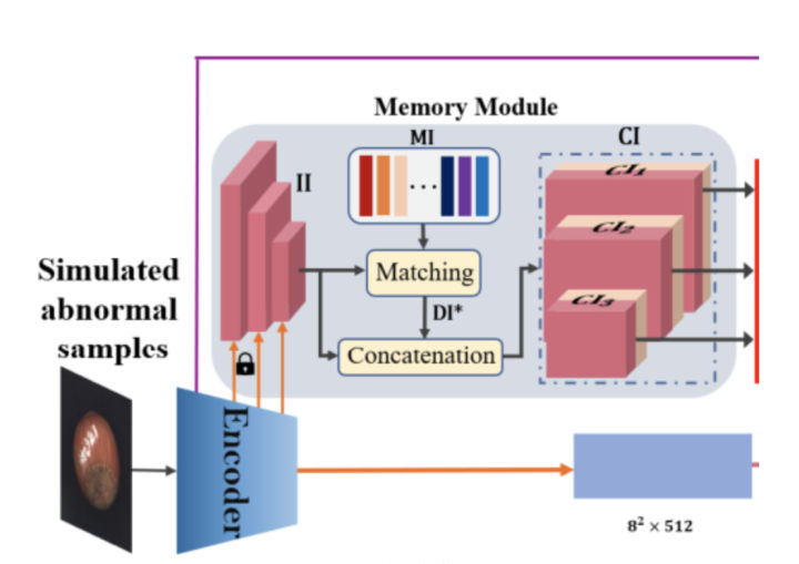 SOTA performance!MemSeg, a new method for surface defect detection in ...