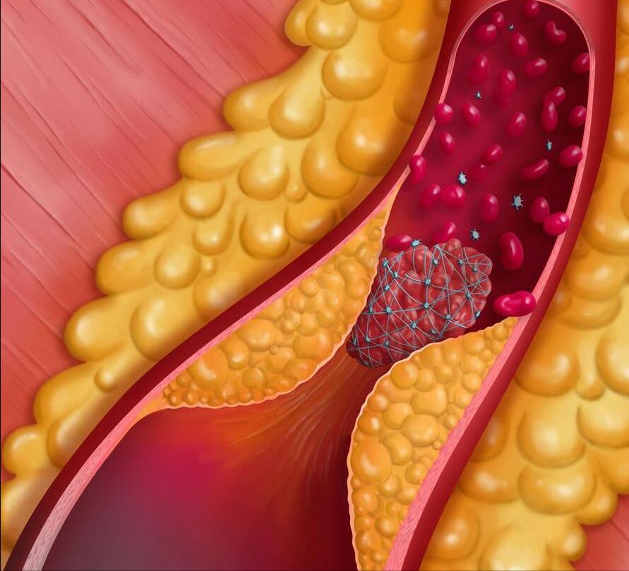 Take aspirin, these things you must know! iNEWS