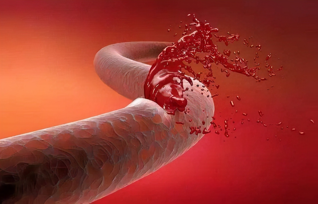 Taking aspirin for a long time will make blood vessels "brittle"?Eat