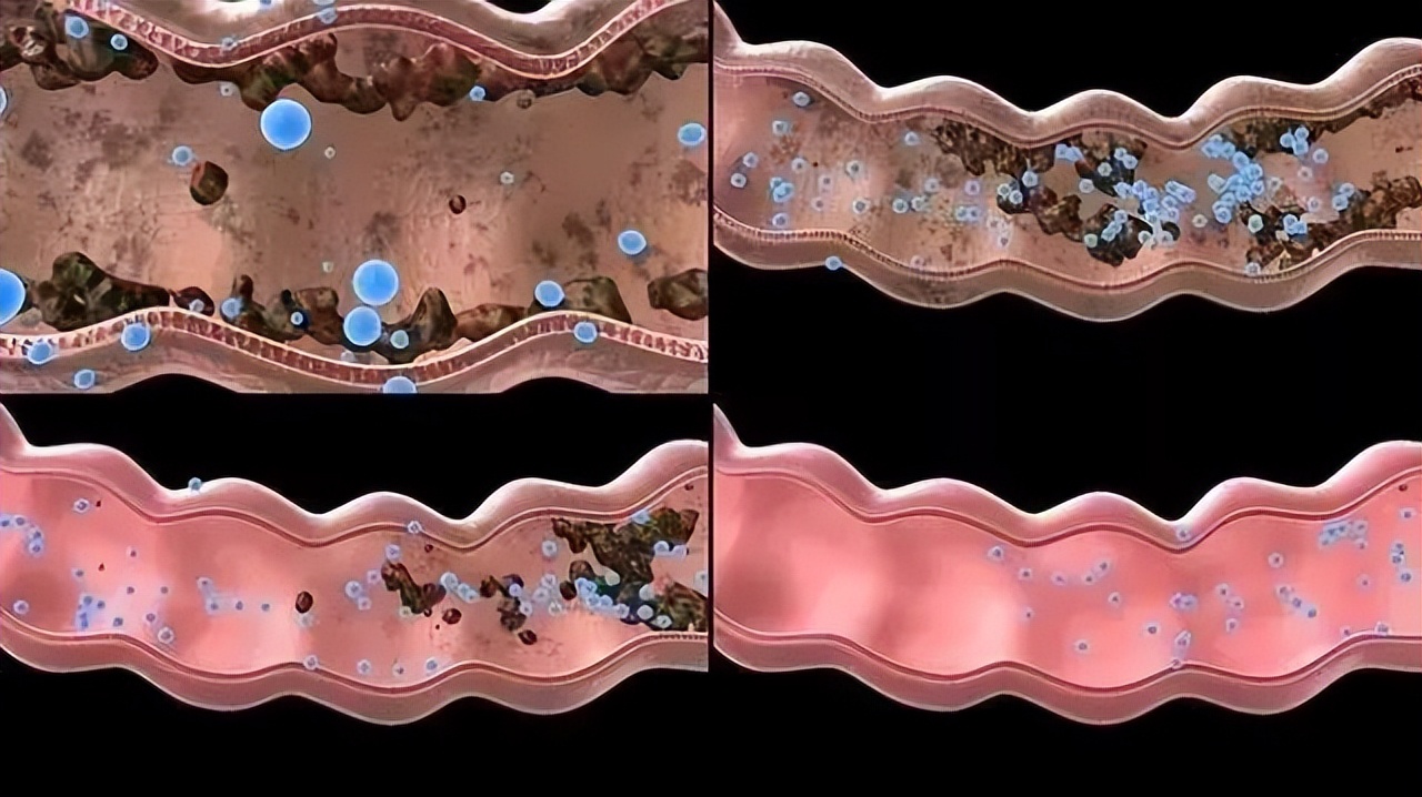 Why do people poop before they die?After knowing the reason, it was