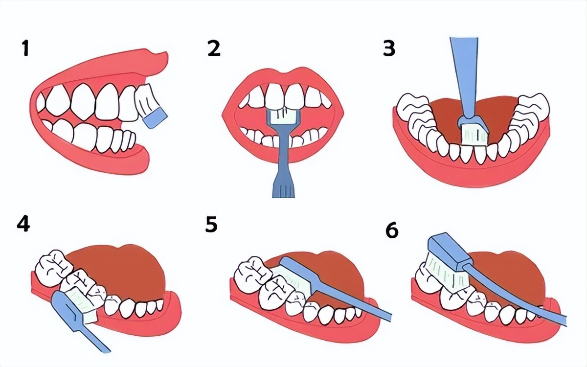 18 major nursing hazards taboos in orthodontics, be careful! - iNEWS