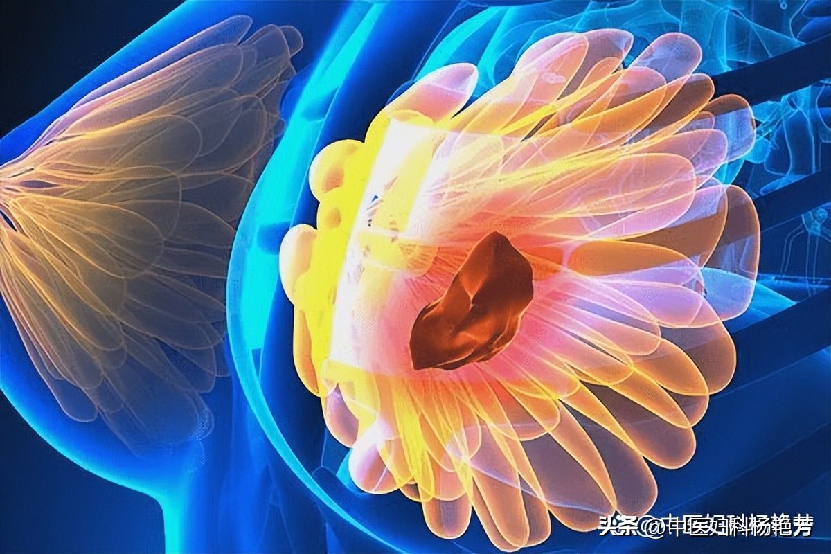 Breast hyperplasia/nodules, is it gas? TCM tells you the truth... iNEWS