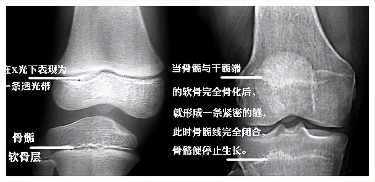 Final Height Calculator - Sage Calculator