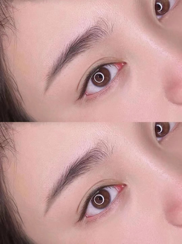 7 reasons for the swollen beauty contact lens line - iNEWS