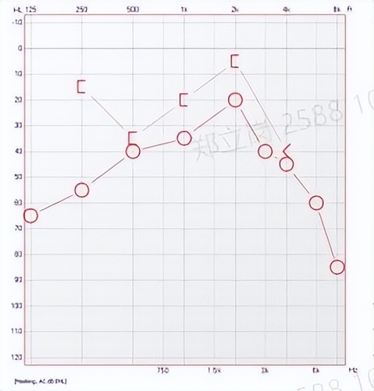 Perforated tympanic membrane, ear pus, hearing loss, can it be cured