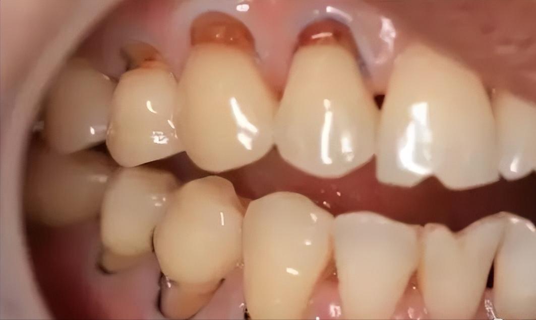 If you brush your teeth like this, your teeth will really break!!! iMedia