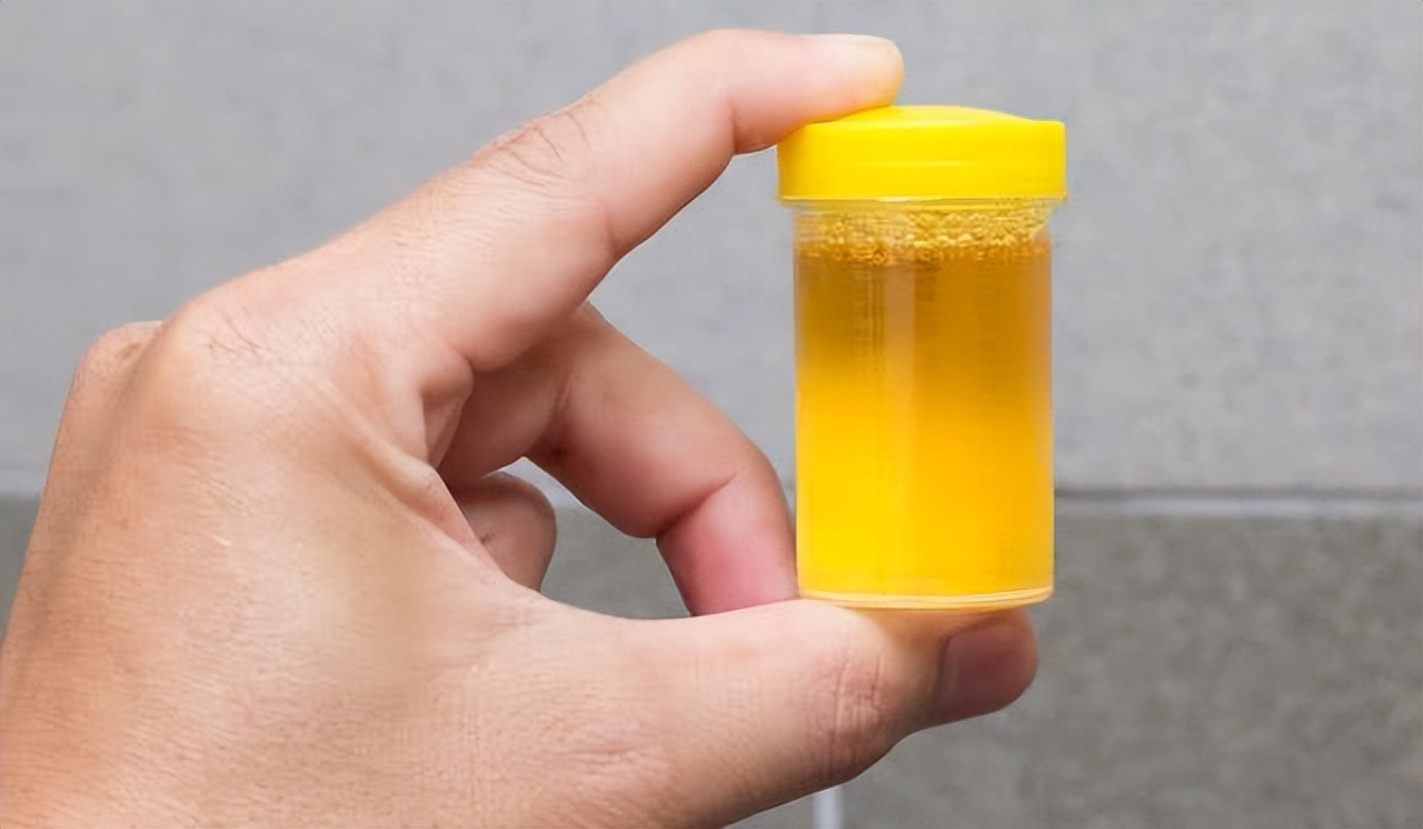 Have you ever seen colorful urine? Some things need to be taken