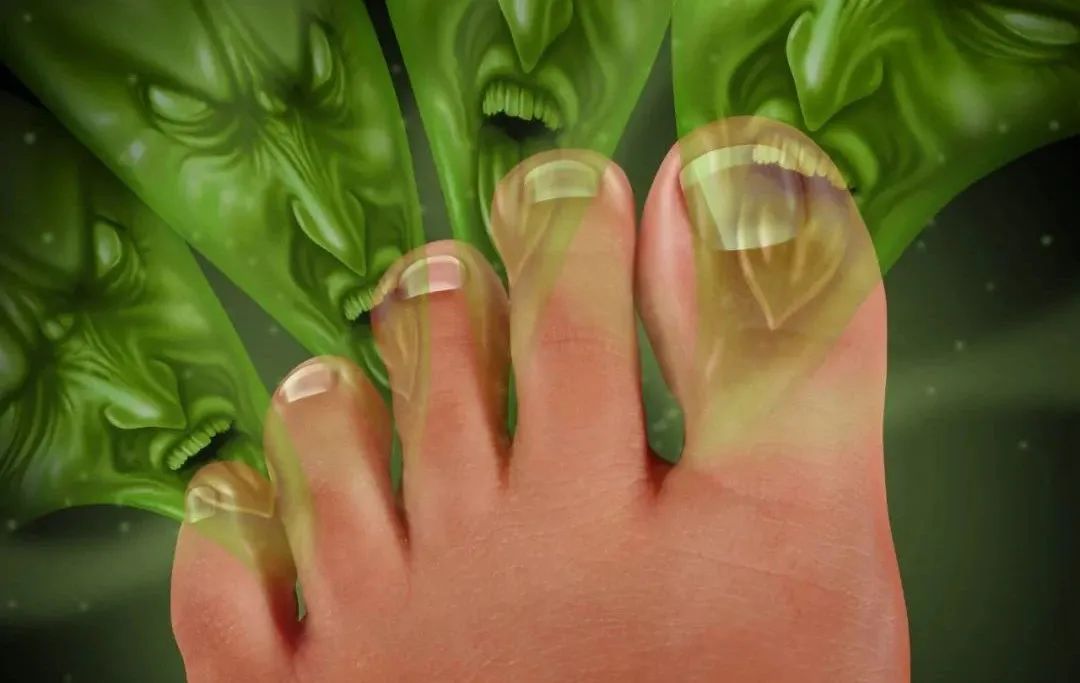 Toenails growing into the flesh? You don't need to pull out your armor