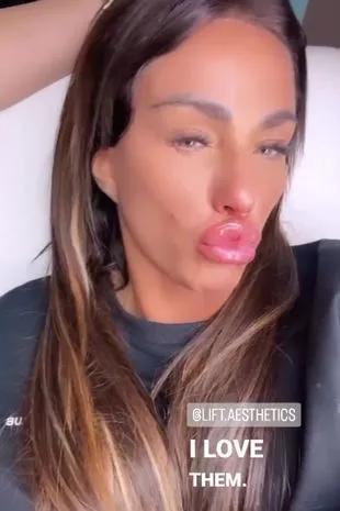 Spectacular Katie Price Shows Off Her 'kissable' New Lips And Covers Up In A Baggy Tracksuit As She Takes A Swipe At Ex-boyfriend Jj Slater By Saying She Wants A Man With 'masculine Energy' Capture for Your Screen Spectacular Katie Price Shows Off Her 'kissable' New Lips And Covers Up In A Baggy Tracksuit As She Takes A Swipe At Ex-boyfriend Jj Slater By Saying She Wants A Man With 'masculine Energy' Capture for Your Screen