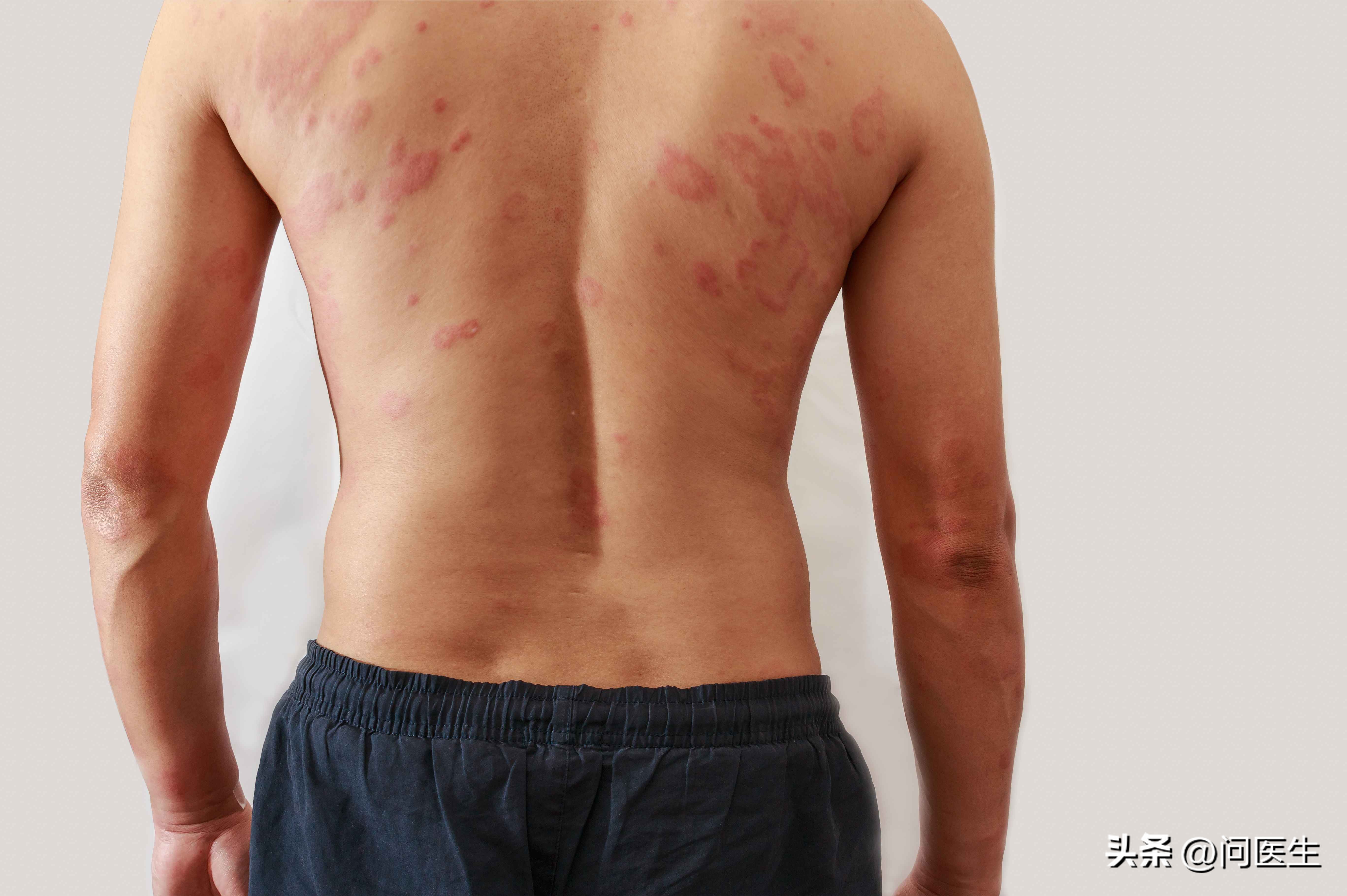 Dense Rash These kinds of conditions often appear on the skin, which may be caused ...