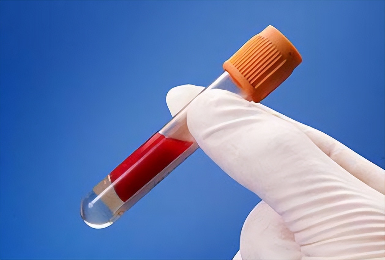 What diseases can blood tests detect? Doctor's reminder If the 5