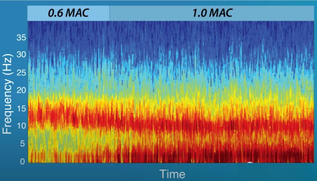 The application of EEG monitoring in the perioperative period, with the ...