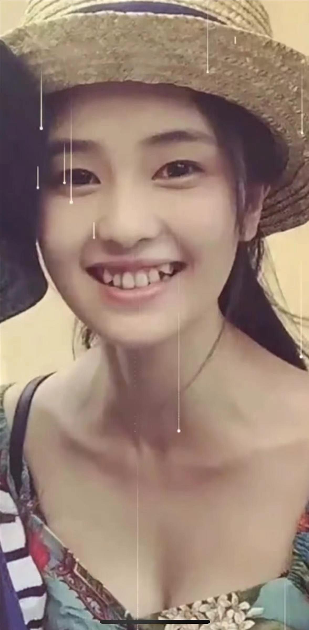 It is really wise for Bai Lu to have his teeth fixed before entering
