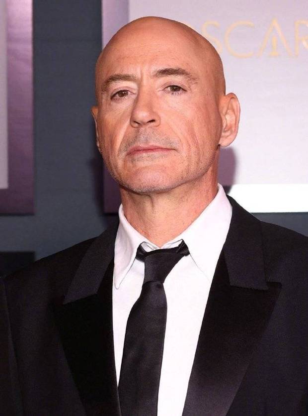 Iron Man is going bald!Robert Downey Jr.'s bald head looks old on the