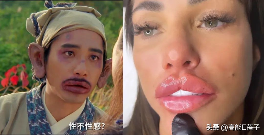 The 45yearold British actress turned her lips into sausage lips of