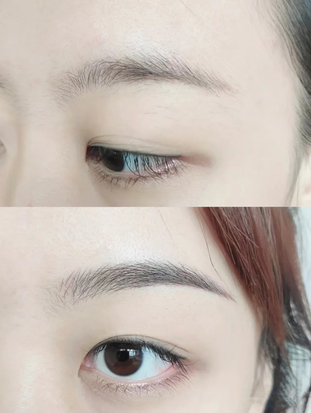 What are the causes of red eyebrows? iNEWS