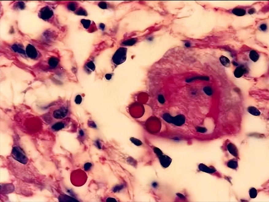 Exploring the protein evolution and bactericidal process of ...