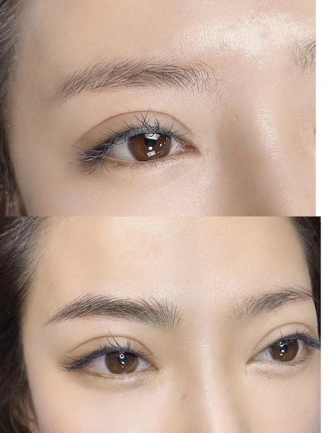 What are the causes of red eyebrows? iNEWS