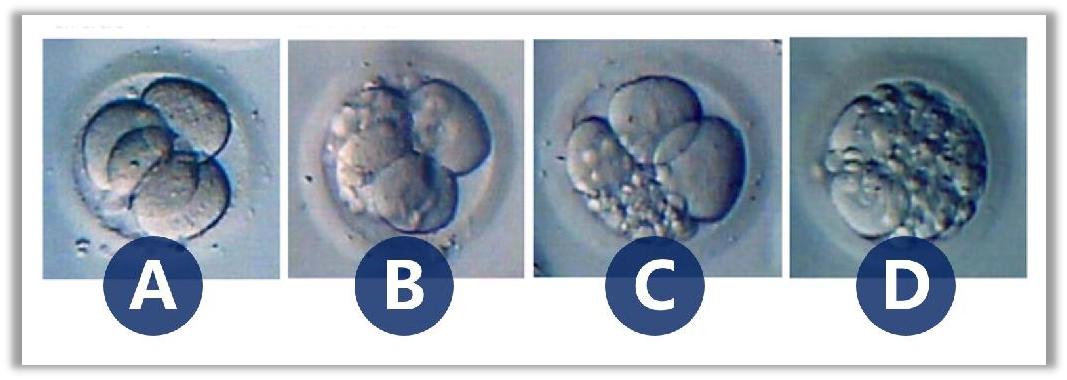 AI algorithm becomes infertility savior! Identify problem sperm and ...