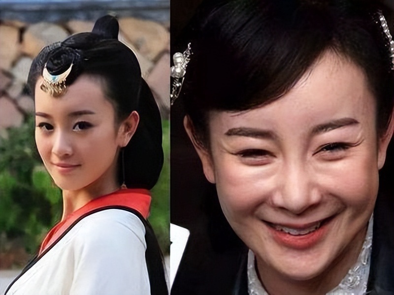 Steamed bun face, awl nose, V chin, why are there more and more 