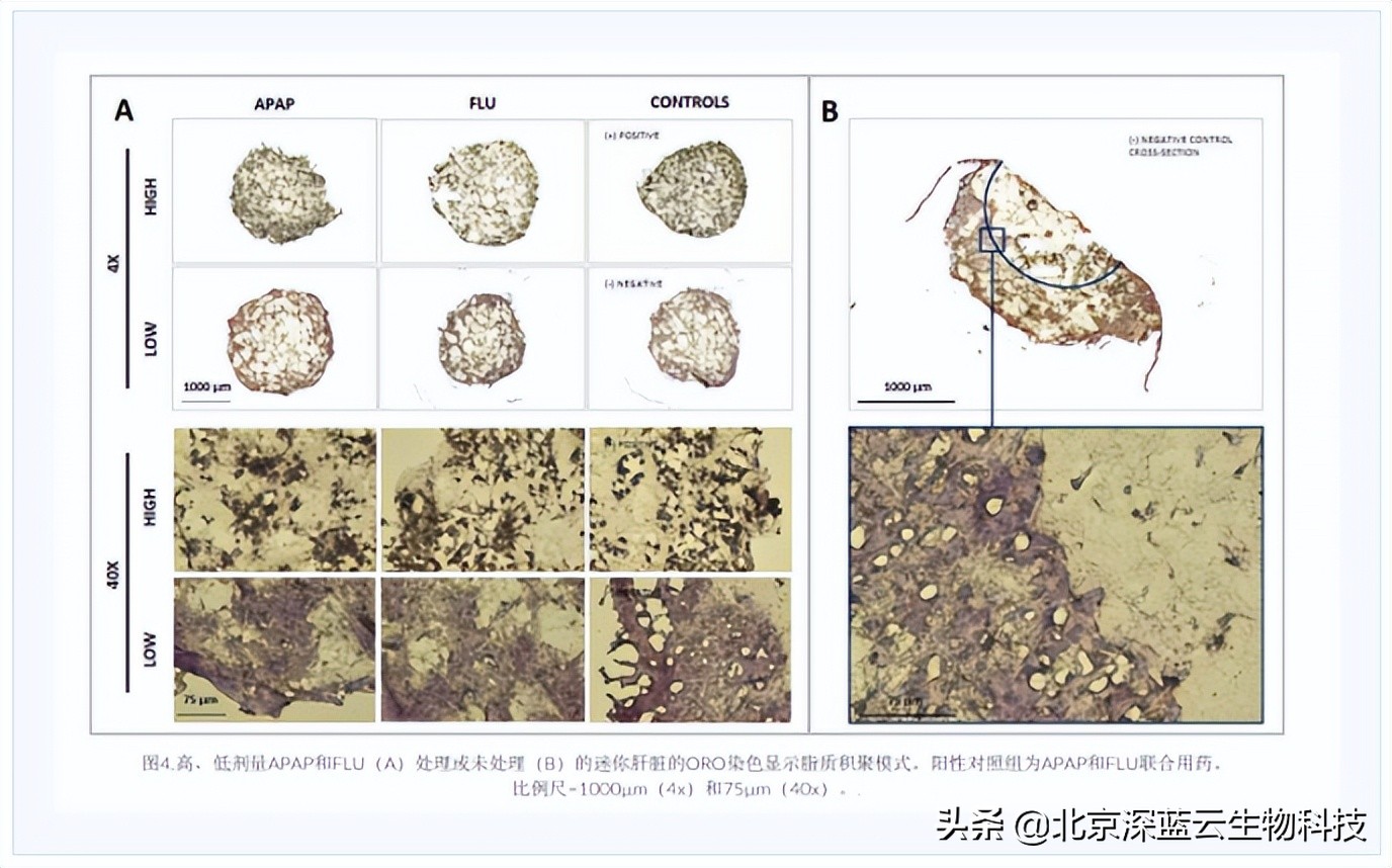 Bioprinted Liver Models To Evaluate Drug Hepatotoxicity Studies - INEWS