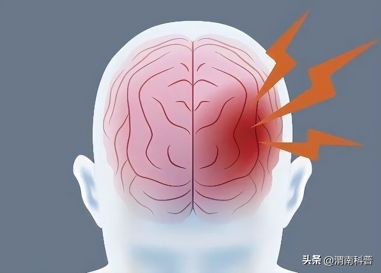 Dizziness and nausea, is the 