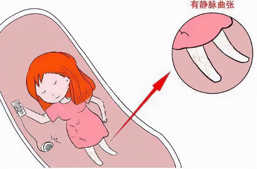 "Dry goods" edema, cramps, numbness in hands and feet... These limbs