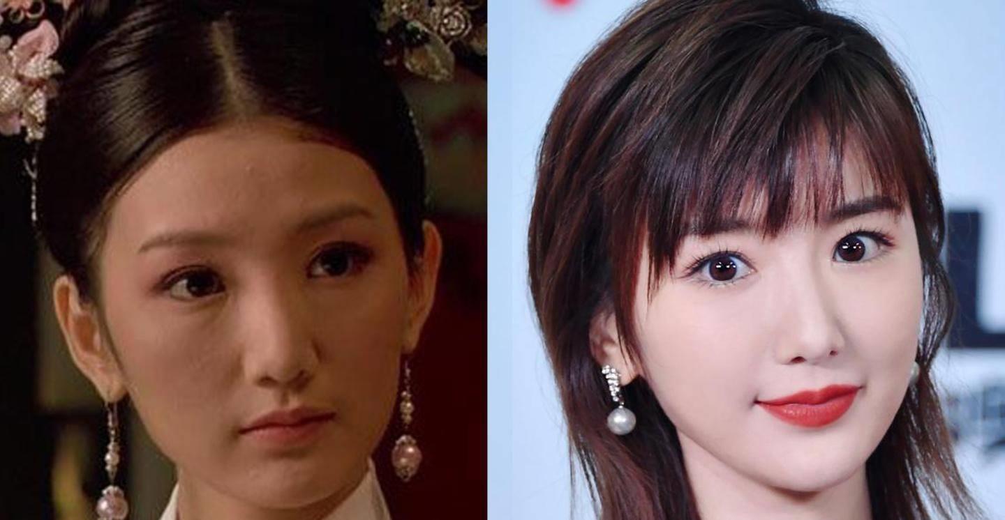 She looks completely different before and after plastic surgery, yet ...