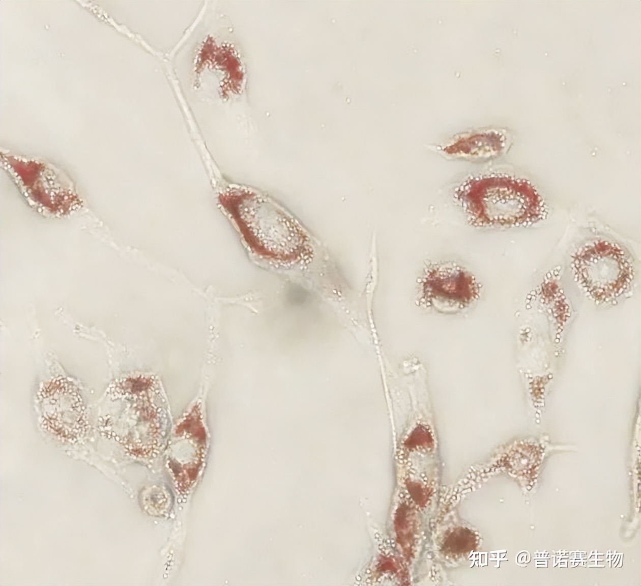 How does THP1 induce differentiation into macrophages and foam cells